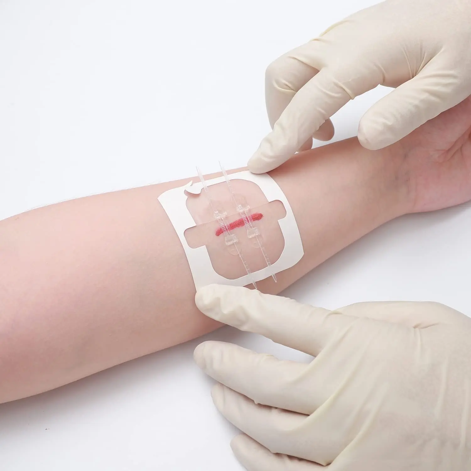 Band-aid de fechamento de ferida indolor para adultos e crianças, fechamento rápido, band-aid com zíper, portátil, band-aid sem costura, cuidados de