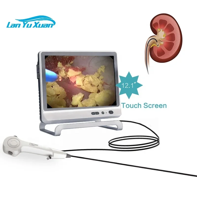 7.5fr 9.5fr flexible disposable ureteroscope disposable urology endoscope digital video ureterorenoscope 2.5mm 2.8mm