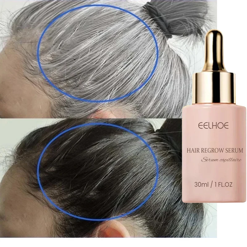 Gray Hair Treatment Serum White To Black Natural Color Hair Growth Liquid Anti Hair Loss Repair Roots Nourish Scalp Men Women