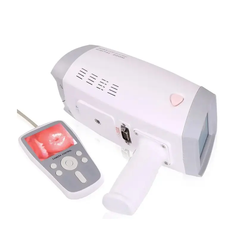 Handheld Portable Digital Colposcope, Electronic Gynecology Vaginal Inspection Diagnostic Instrument