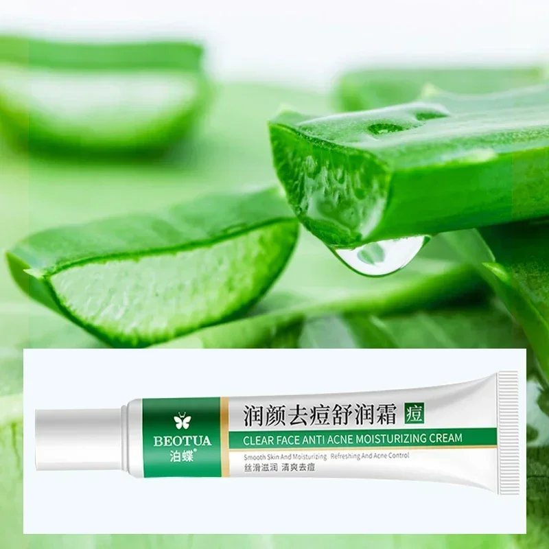 Effective Acne Removal Cream Aloe Acne Spots Oil Control Anti-aging Moisturizing Whitening Acne Cream Treatment Skin Care 20g