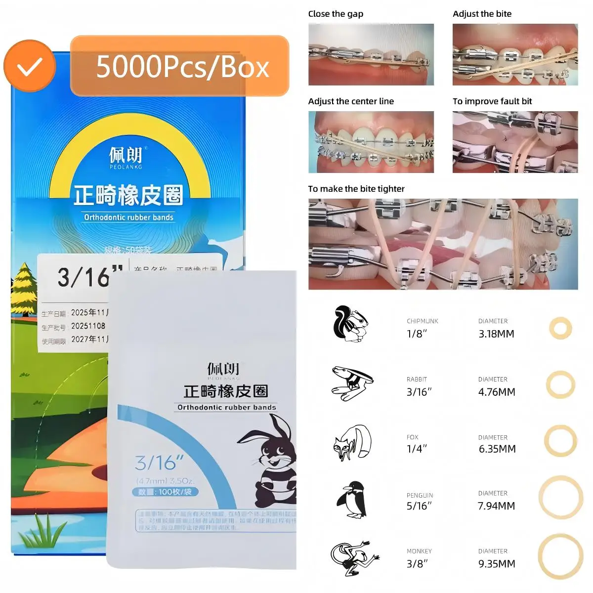 

5000 шт./упак. Стоматологические ортодонтические эластичные резинки для брекетов, латексные лигатуры, резинки для зубов, высококачественные