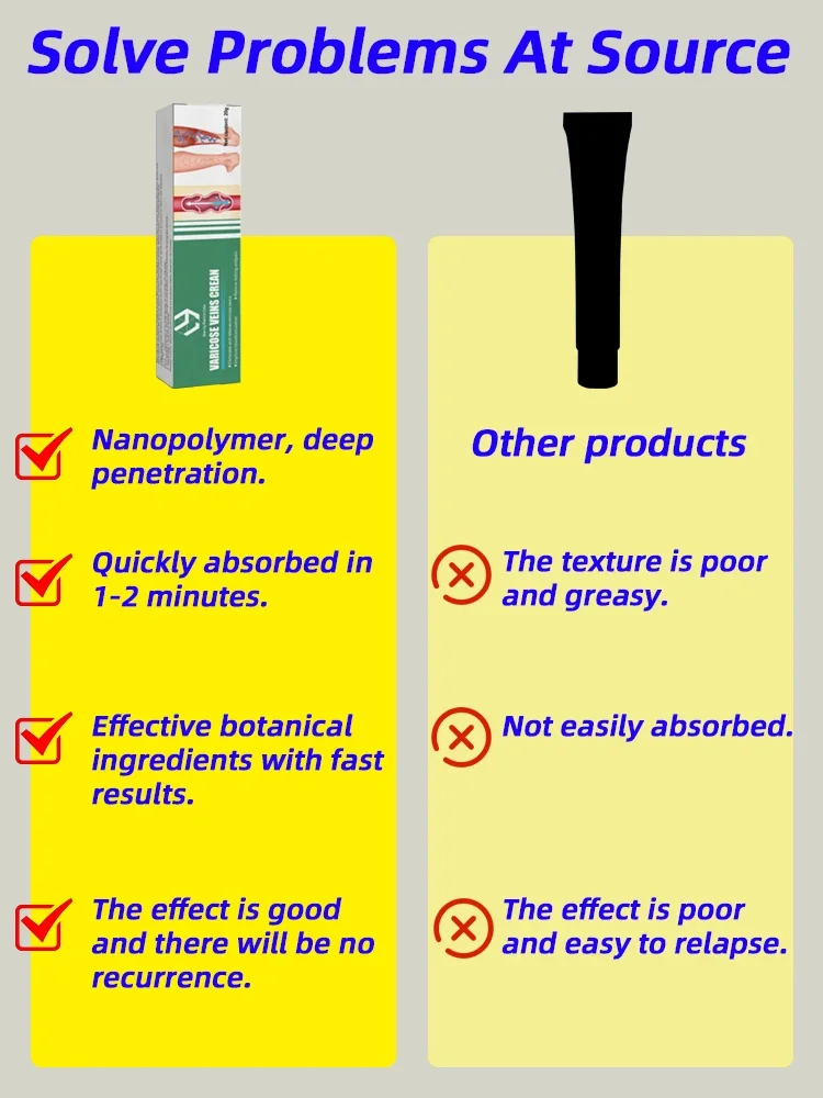 Crema Varicose