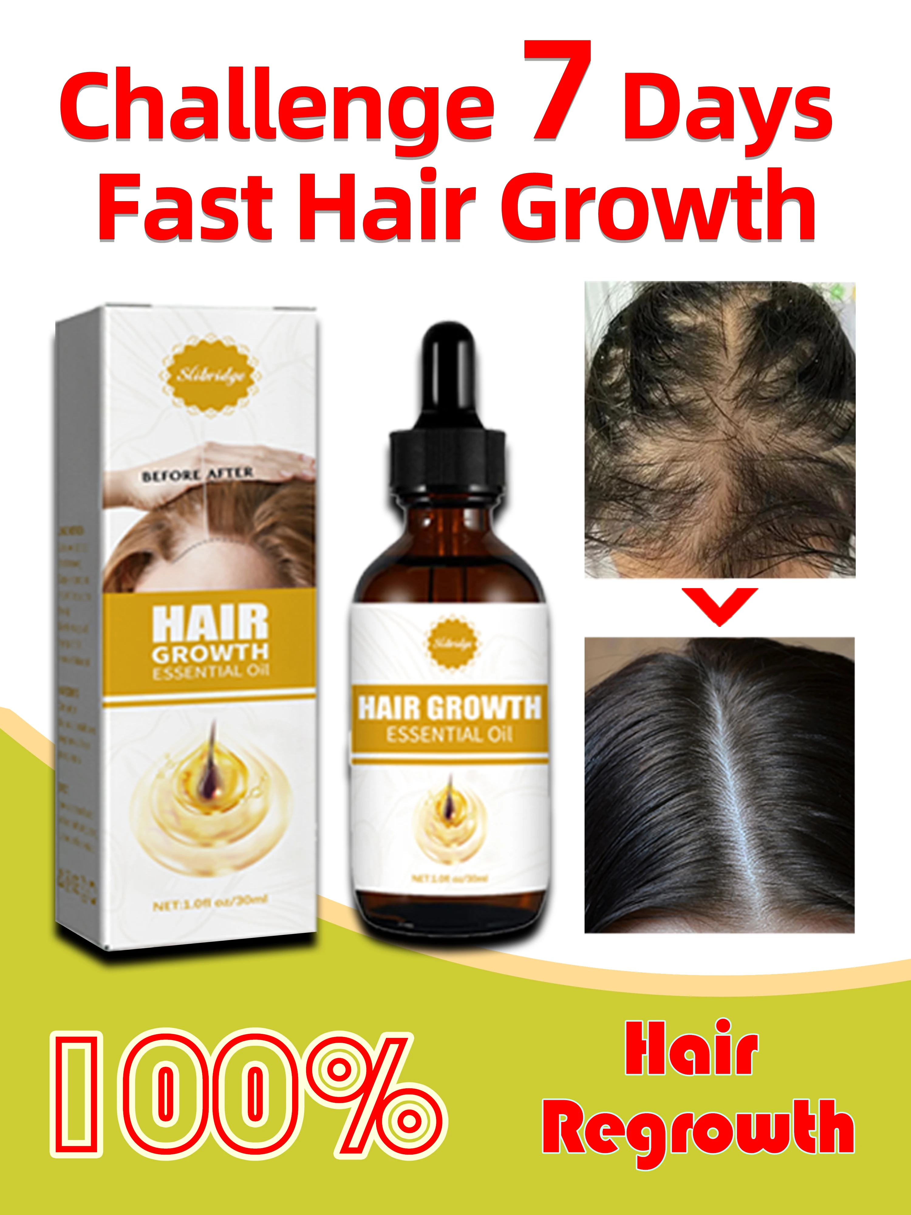 Oil growth hair