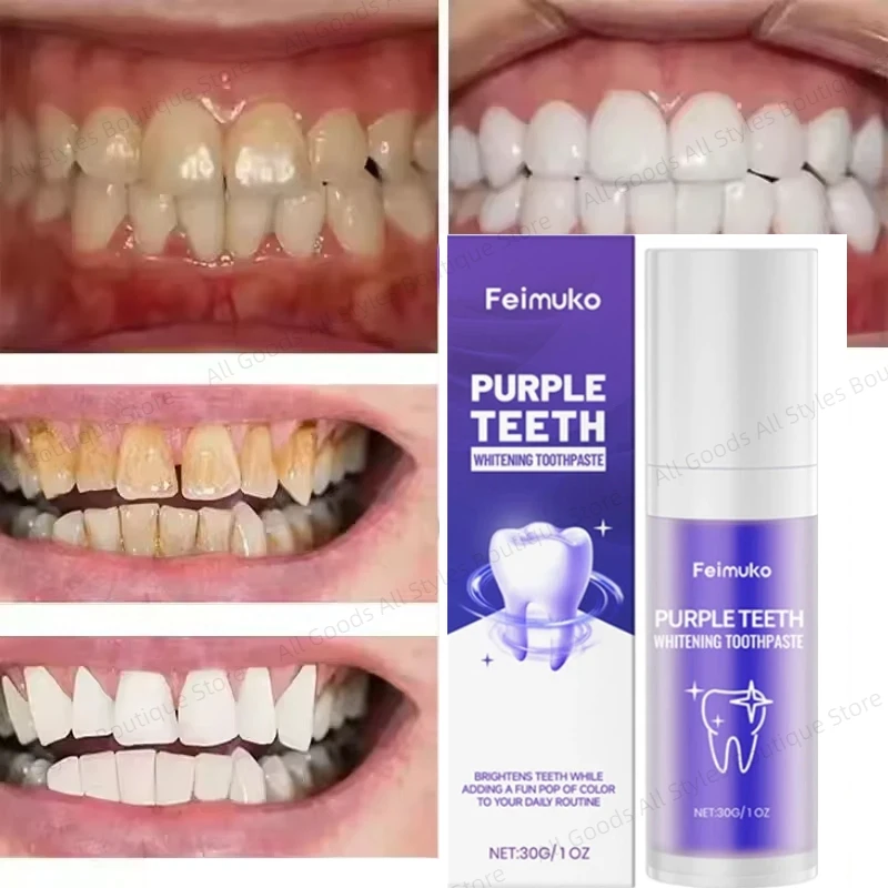 

Фиолетовая зубная паста освежает дыхание защищает десны стабилизирует эмаль для зубов ежедневная чистка зубная паста для ухода за полостью рта 30 г