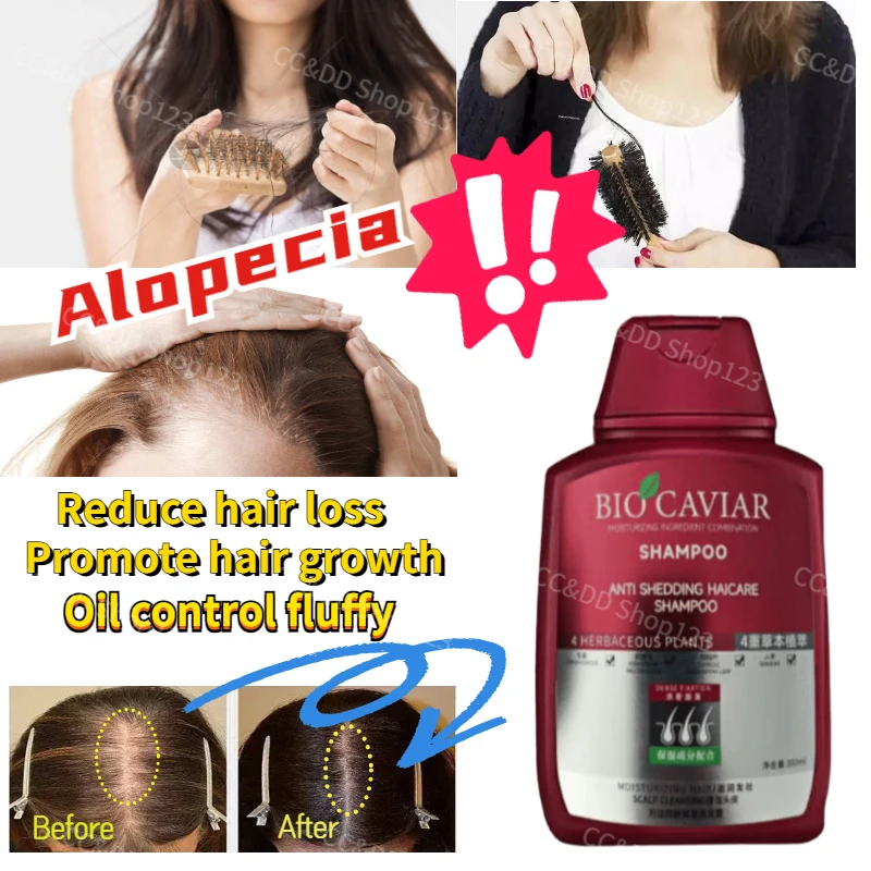 

350ml Herbal Extract Anti-Decomposition Hair Shampoo Effectively Reduce Hair Loss and Control Oil Hair Fluffy