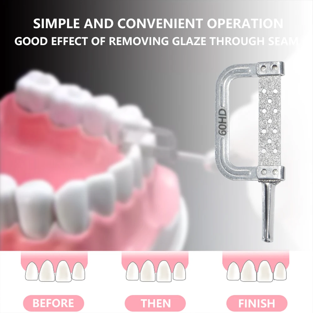 MBM 5 uds sierra de molienda Dental de doble cara para ortodoncia reducción de esmalte interproximal IPR tira de pulido automático 15-90HD