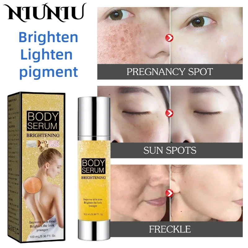 

Melasma Brightening Moisturizing Cream Reduce Melanin Brighten Cream Lighten Dark Skin Chloasma Serum Fade Fine Lines Face Care