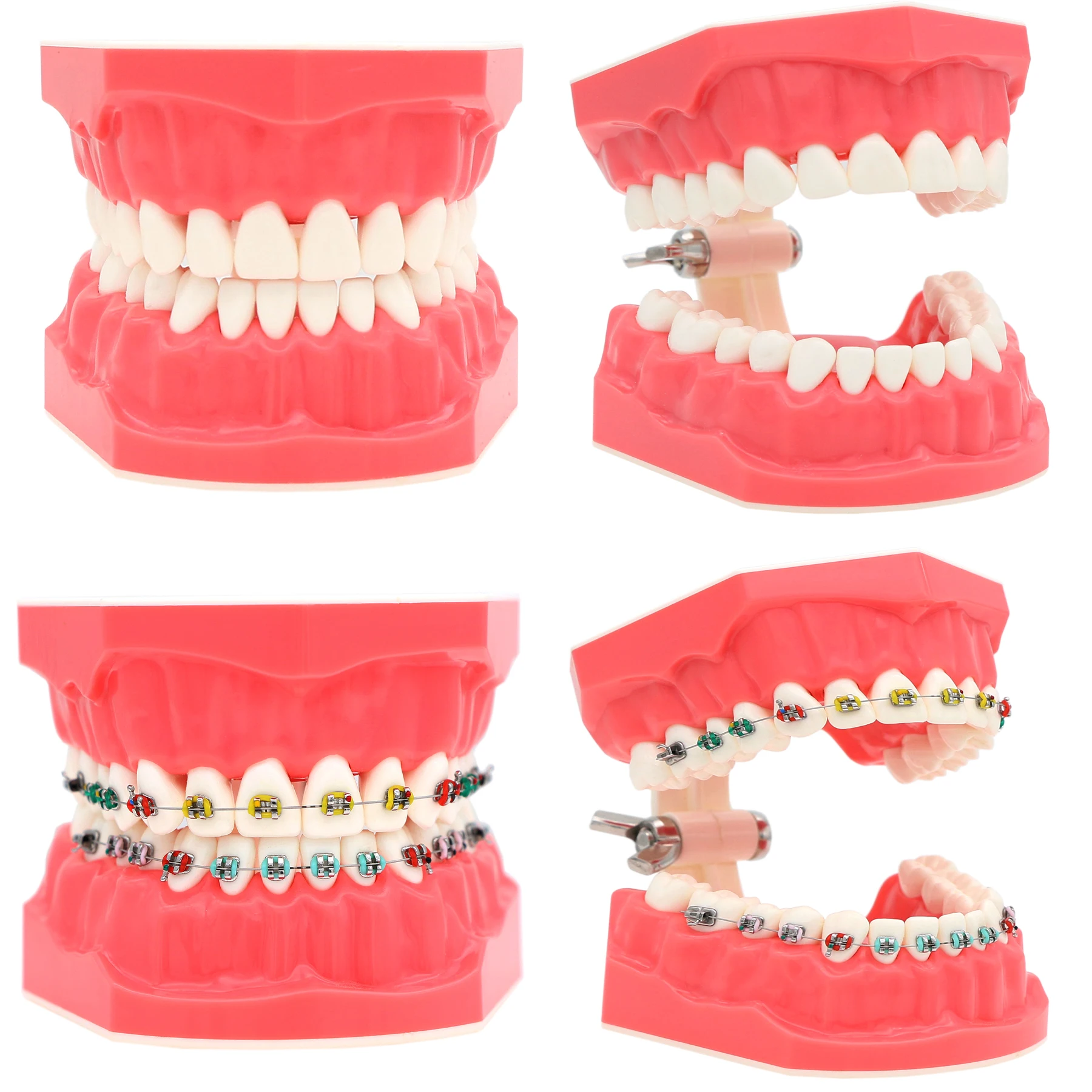 Dental Teaching Model Dentistry Orthodontic Teeth Model With Brackets For Dentist Studying Patient Demo