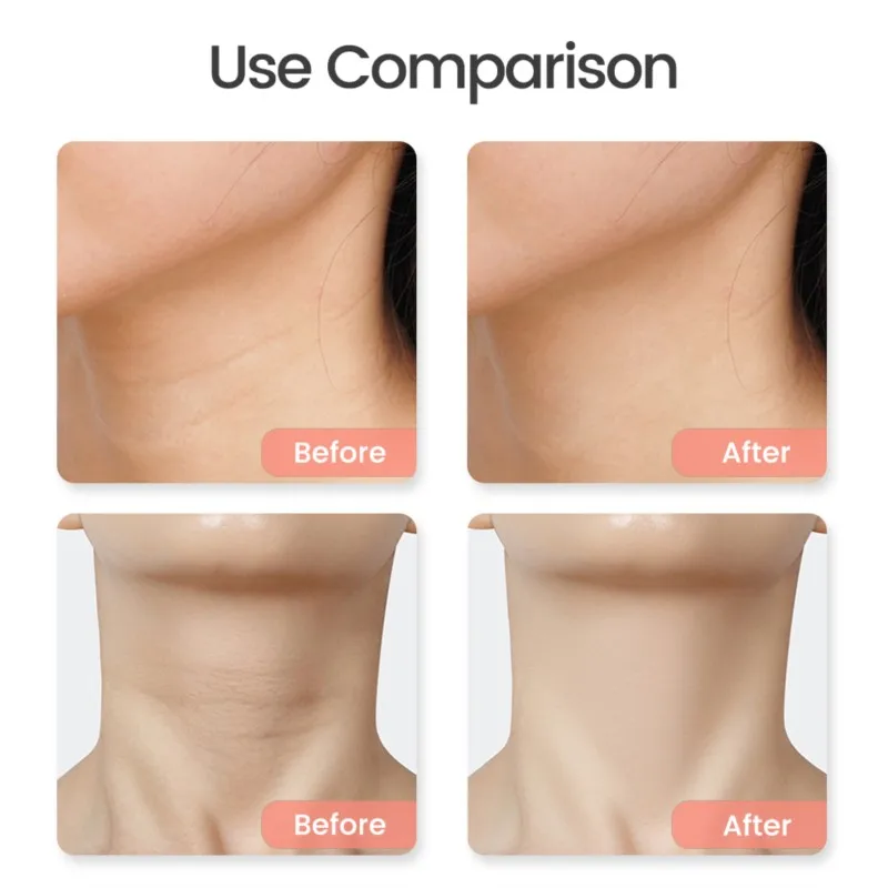 Instrumento de moxibustión eléctrico USB para el hogar, instrumento de moxibustión cálido, masajeador, piedra plana, calor, masaje facial, cuello