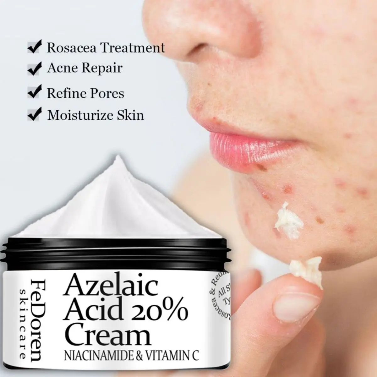 Desvanece-se Acne Creme Sarda Pigmentos Escuros Melanina Alfa Arbutin Creme Rosto Cuidados Com A Pele