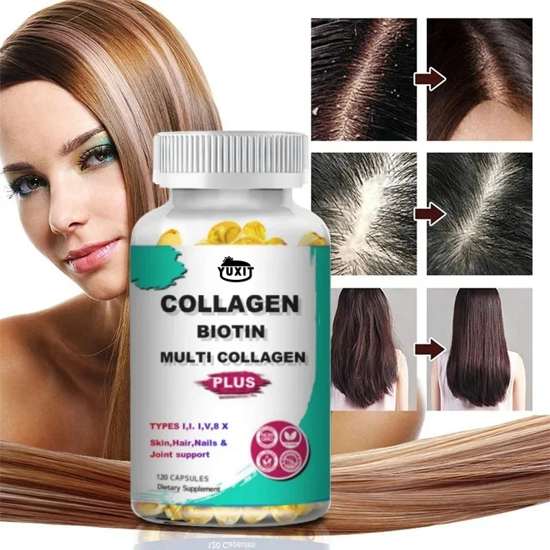 YUXIT   Collagen Multi Collagen Capsules - Types I, II, III, V & X - Skin Healthy Dietary Supplement, Skin, Nails 120 Capsules