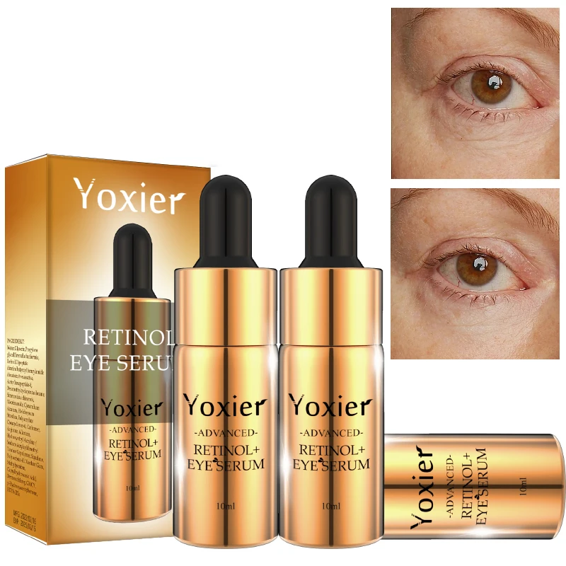 

Retinol Eye Serum Moisturizes And Smooths The Skin Improves Dark Circles Moisturizes Tightens And Enhances Eye Care