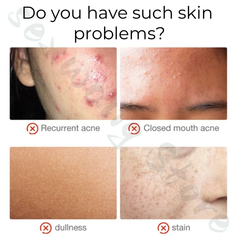 アストラガルス配合のベアフェイスクリームは、小じわを薄くし、肌の色合いを均一にし、シミをカバーし、顔のくすみやざらつきを改善します。