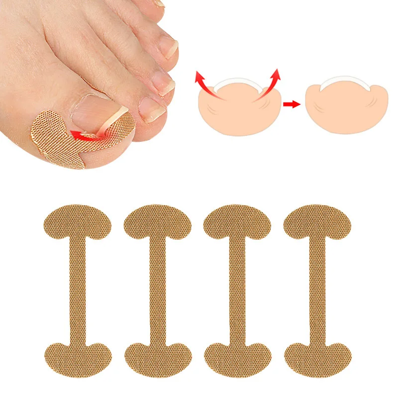 20-100pcs Ingrown Toenail Correction Strips Lasting Adhesion Waterproof Nail Correction Stickers Elasticity Toe Care Pedicure