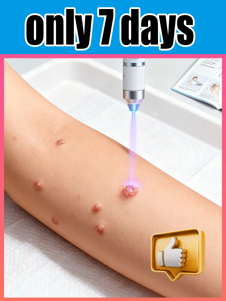 

ʙʟᴜᴇ ʟɪɢʜᴛ ᴘᴇɴ sᴏʟᴠᴇ ᴡᴀʀᴛs, ʜᴏᴛ sᴀʟᴇ ᴡᴀʀᴛ ᴄᴀʀᴇ ᴛᴏᴏʟs