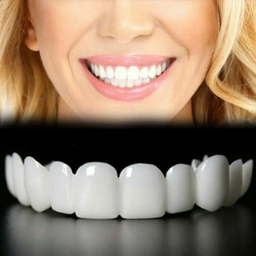 2 Pairs Adjustable for Men and Women Top and Bottom Regain Confident Smile