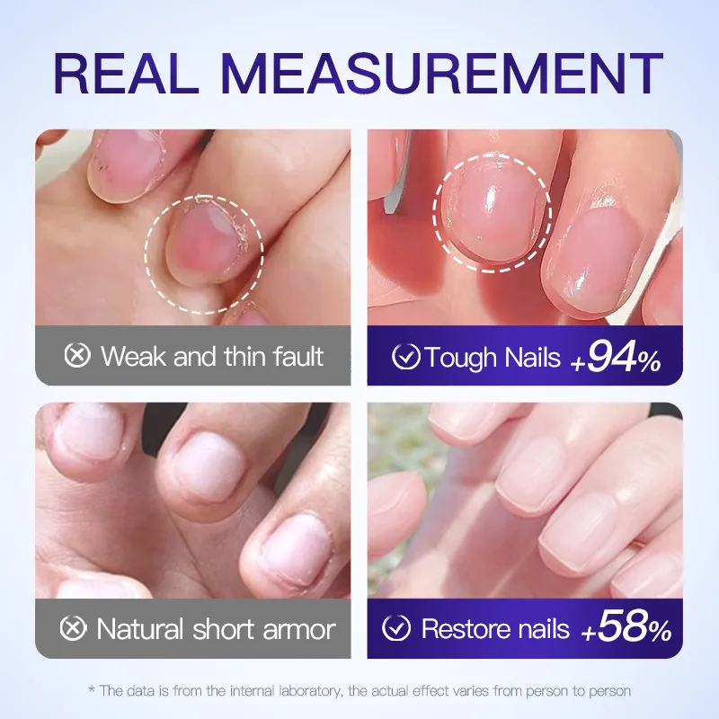 30 مللي زيت مغذي للبشرة يغذي استعادة الأظافر التالفة فيتامين زيت العناية بالأظافر تليين يرطب القوة