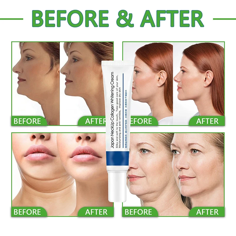 Neck Lines Protein Hidratante Creme, Lift Hidratante, Eliminar o Chin Duplo, Linhas Finas, Anti-Envelhecimento, Clareamento