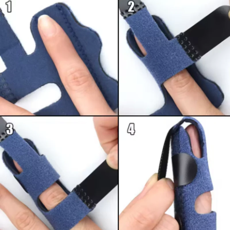 1/3/5 Stück gemischte Fingerfixierungsschienen, Handstütze, Fingerknochenklammer, Fünf-Finger-Stabilisator, Gelenkrichtungs-Korrektor – Detail 5