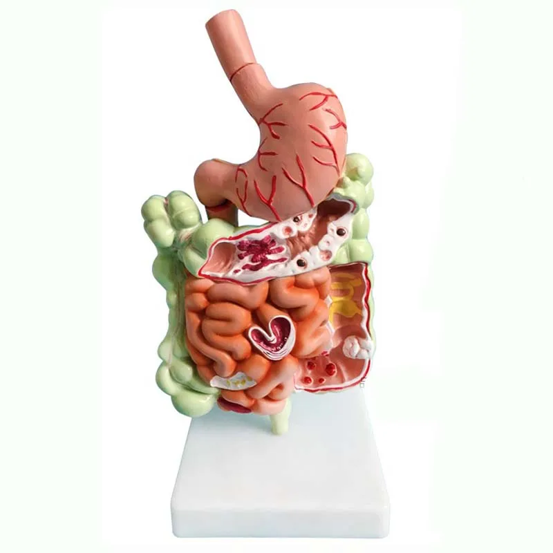 Modelo de anatomía del Sistema Quirúrgico humano, herramientas de enseñanza médica, envío directo