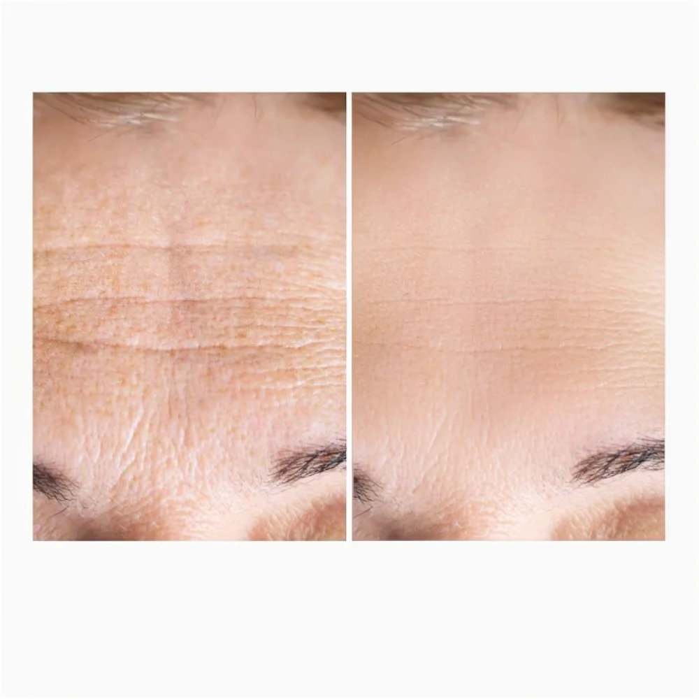 Moisturizing Collagen Face Cream Hydrating Skin Care Lotion Nourishing Essence Smoothing Dryness Daily Face Care For Smoothness