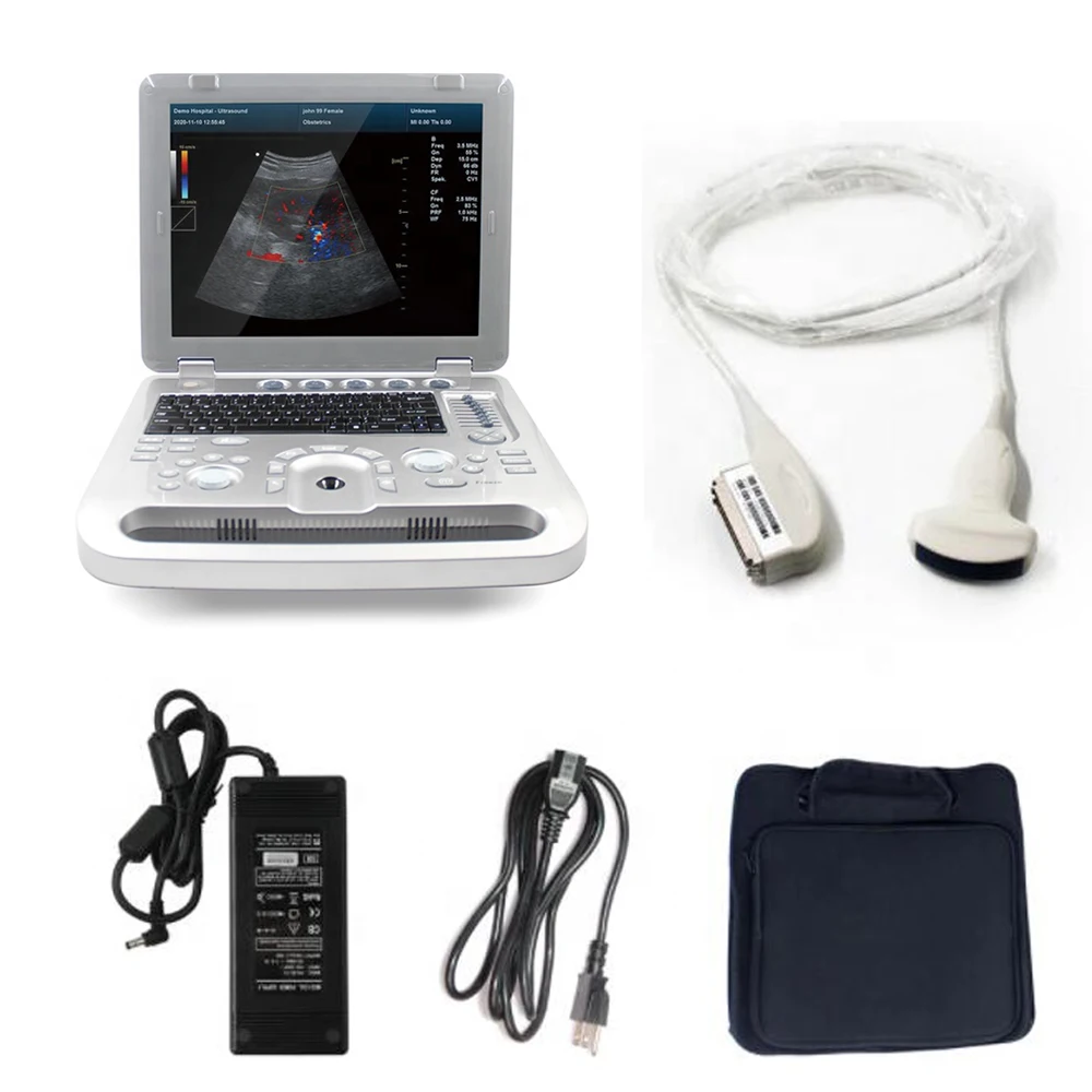 Portable ultrasound system  color Doppler ultrasonic diagnostic  ultrasound machine