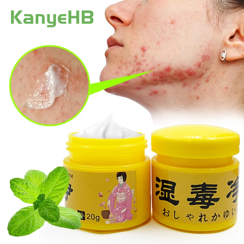 

2pcs Medical Antibacterial Cream Relieve Psoriasis Acne Dermatitis Eczema Against Fungal Infection Antipruritic Ointment A1072