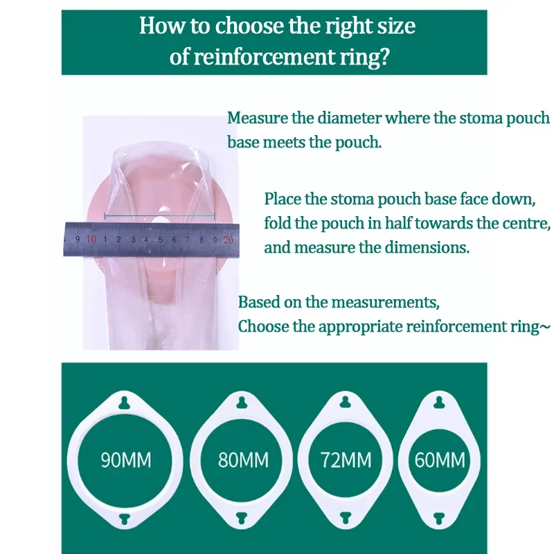 1Set Stoma Bag Reinforcement Belt&Ring Buckle Style Adjustable Elastic Ostomy Bag Abdominal Fixation Belt Reinforced Ring