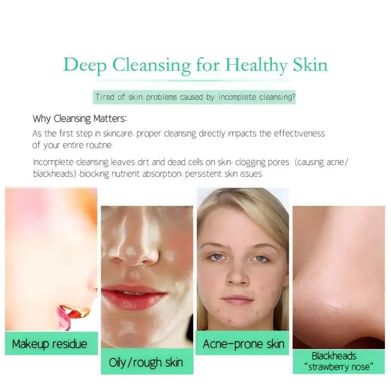 4-in-1 elektrische gezichtsreinigingsborstel – Diepe poriënreiniging, exfoliëren, massage- en mee-eterverwijdering, oplaadbaar huidverzorgingshulpmiddel