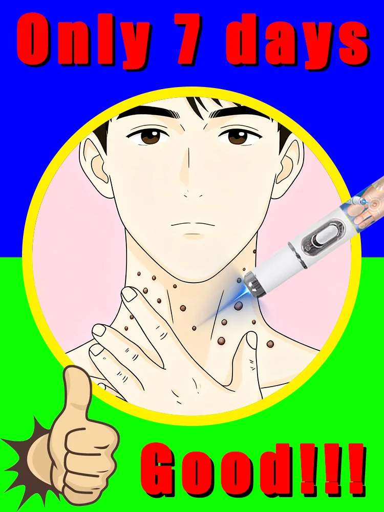 

free shipping,blue light pen solve warts,quickly,wart care tools,feet,shoulders,neck,head,hands