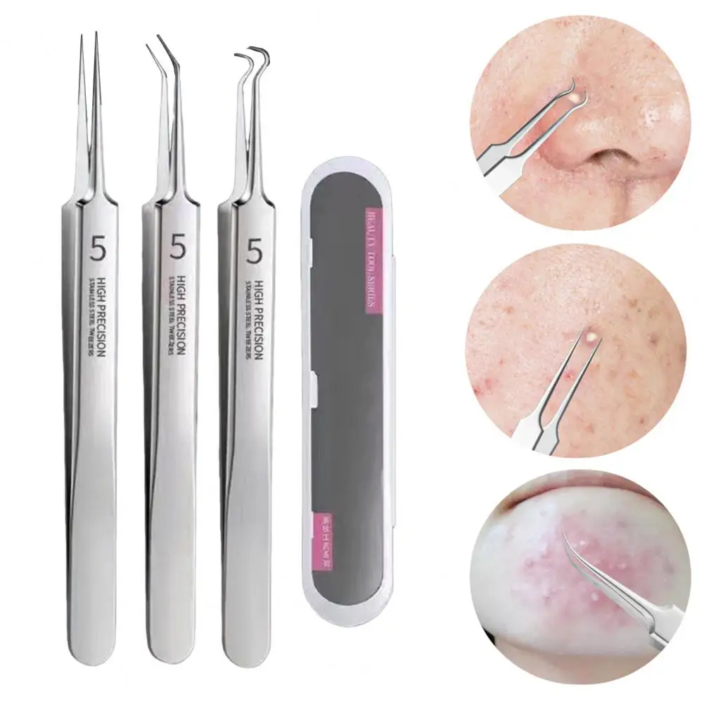 Blackhead Remover Tweezers Stainless Steel Acne Tool Non-slip Handle Blackhead And Acne Kit for Healthy Skin Facial Tools