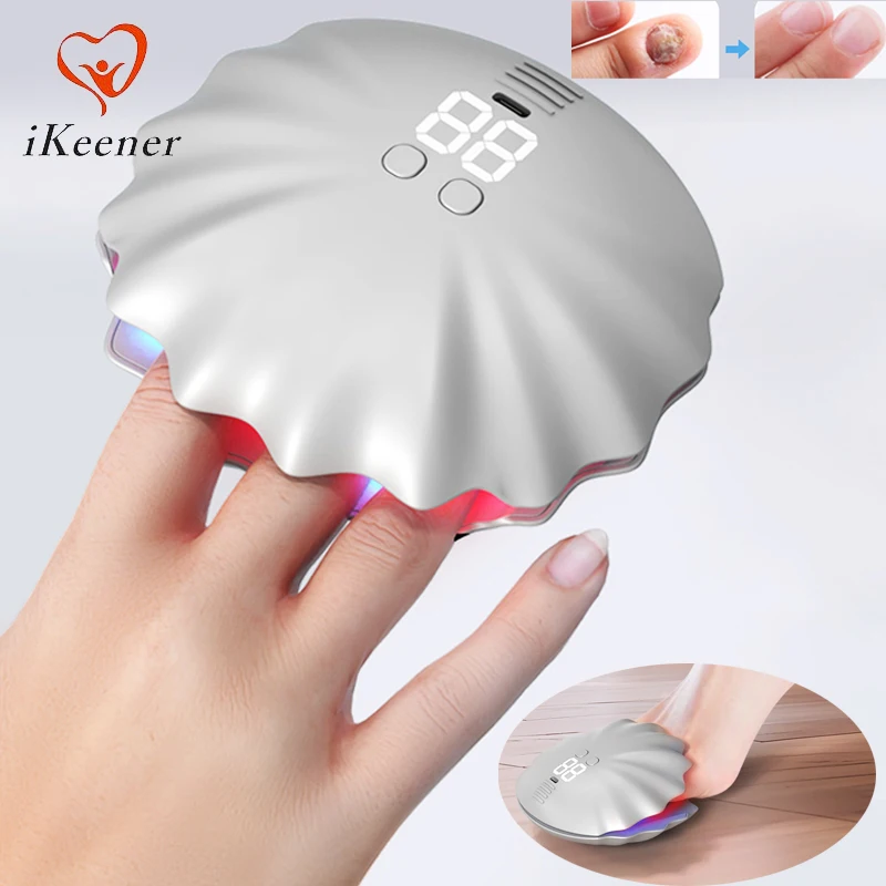 

New Nail Fungus Laser Treatment Device Red Blue Light 910nm Infrared Light Onychomycosis Therapy Repair Fingernails Rechargeable