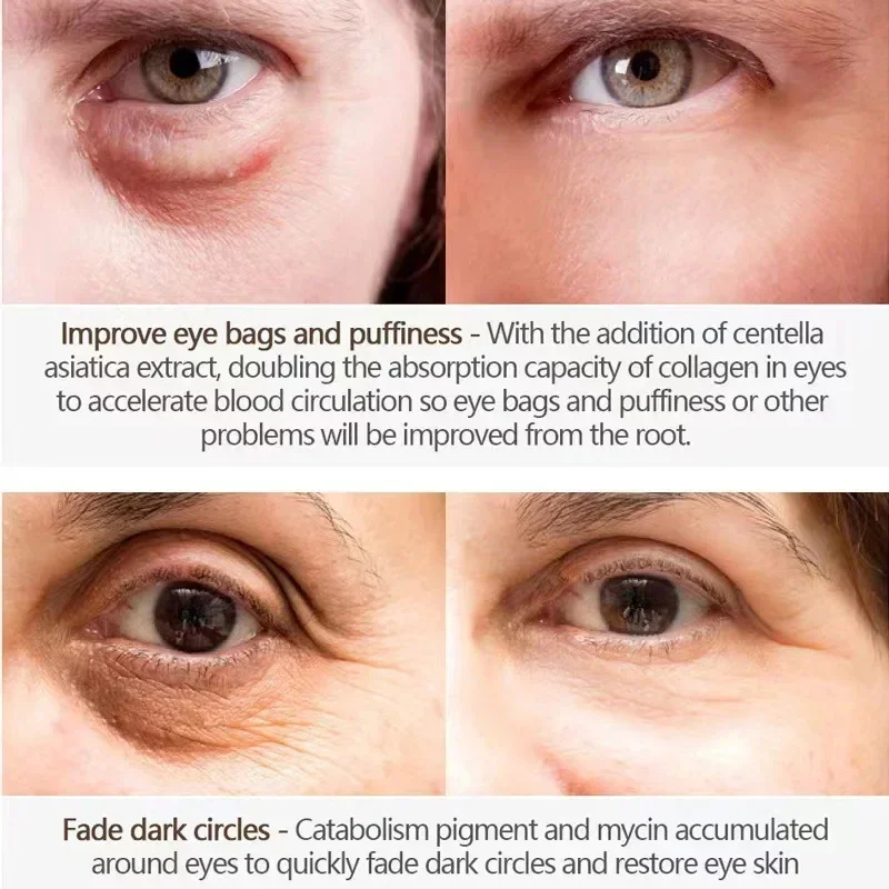 Eyes Bag Remove Collagen Eye Patch Instant Fade Fine Lines Dark Circles Fat Particles Moisturizing Anti-Puffiness Korea Eye Care