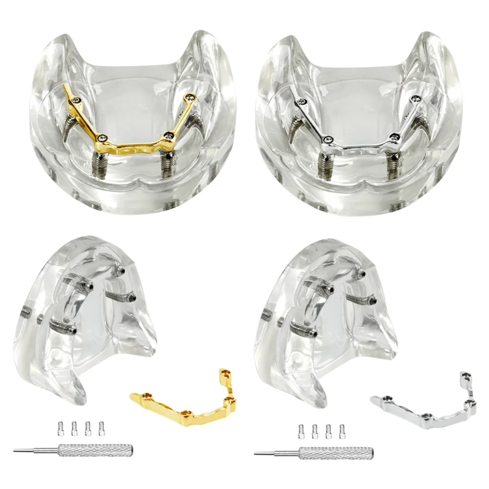 

Стоматологическая модель без зубов с 4 имплантатами, серебряный/золотой стержень, нижняя часть челюсти, восстановление зубов, демонстрационная модель для образования, учебы