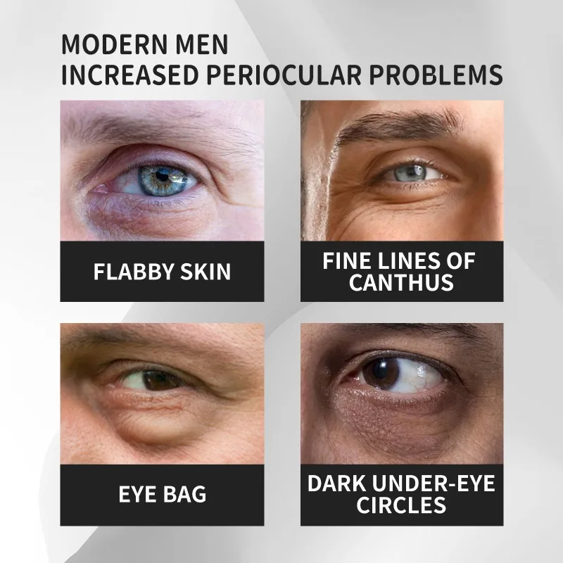 Men's Eye Cream Repair Eye Bags Dark Circles remove Fine lines Fade Wrinkles Anti aging Moisturizing brighten Firming Eye care