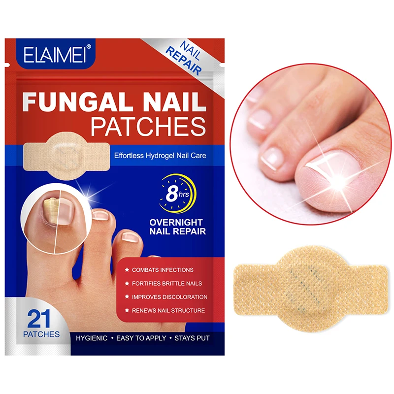 21Pcs Nail Fungus Patch Waterproof Nail Repair Patch Ingrown Correction Sticker Discolored Damaged Nail Gray Care Patches