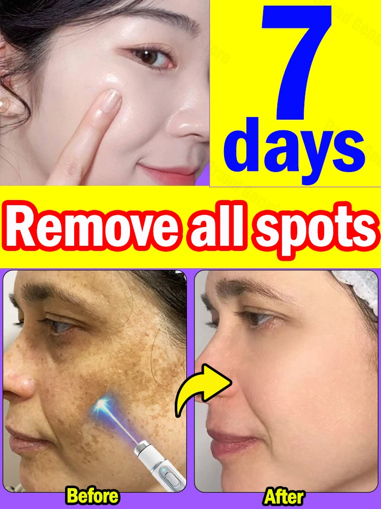 

Facial Spots Quickly Disappear