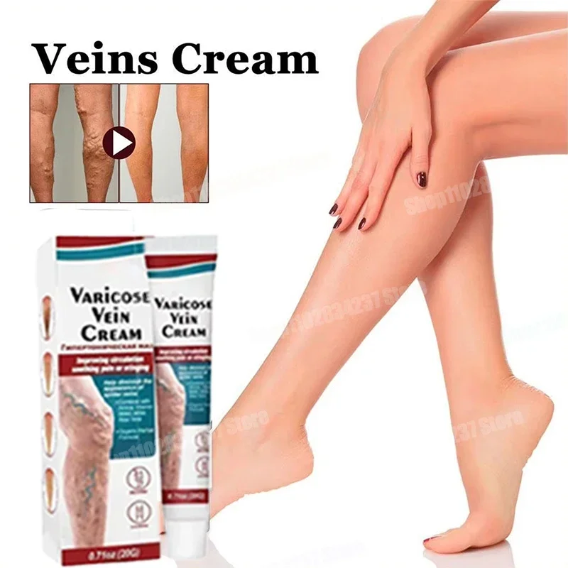 Vein repair cream reduces varicose veins, promotes blood circulation and vasoconstriction essence of leg care