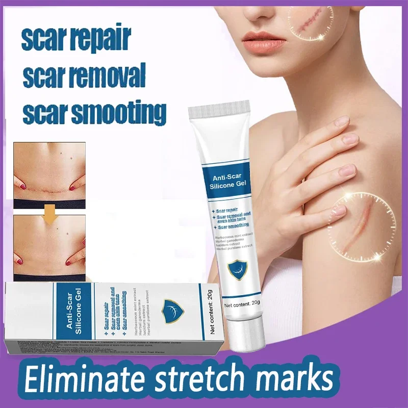 

Stretch Mark Remover Permanent Stretch Mark Removerstretch marks remove scars