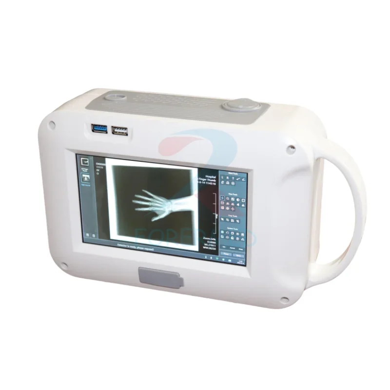 Fashion Medical Portable DR X-ray System Built-in Computer Hand held Flat Panel Detector X-ray Touch Screen Digital Xray Machine