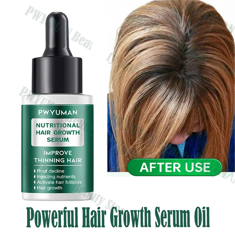 Powerful Hair Growth Serum Oil Repair Nourish Hair Root Regrowth Anti Hair Loss Treatment Essential Oils Men Women Hair Care