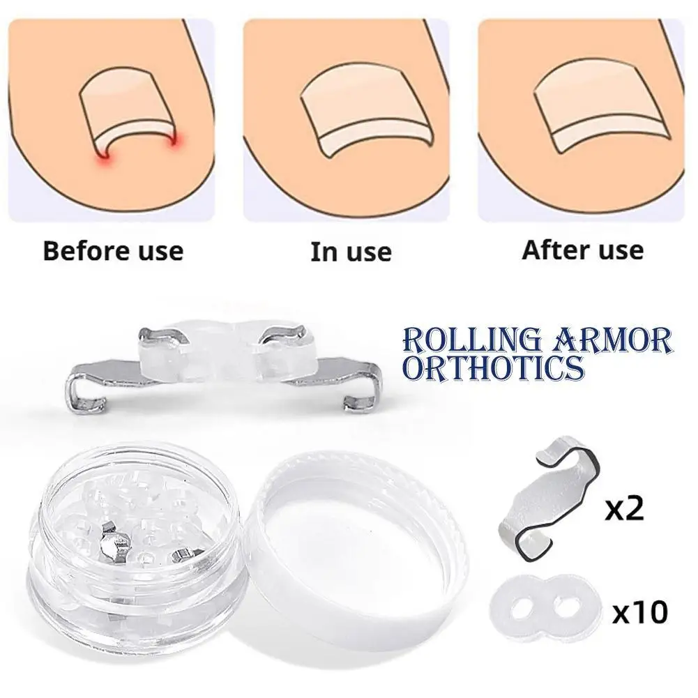 

1set Ingrown Toenail Correction Tool Ingrown Toe Nail Treatment Elastic Patch Sticker Straightening Clip Brace Pedicure Tool