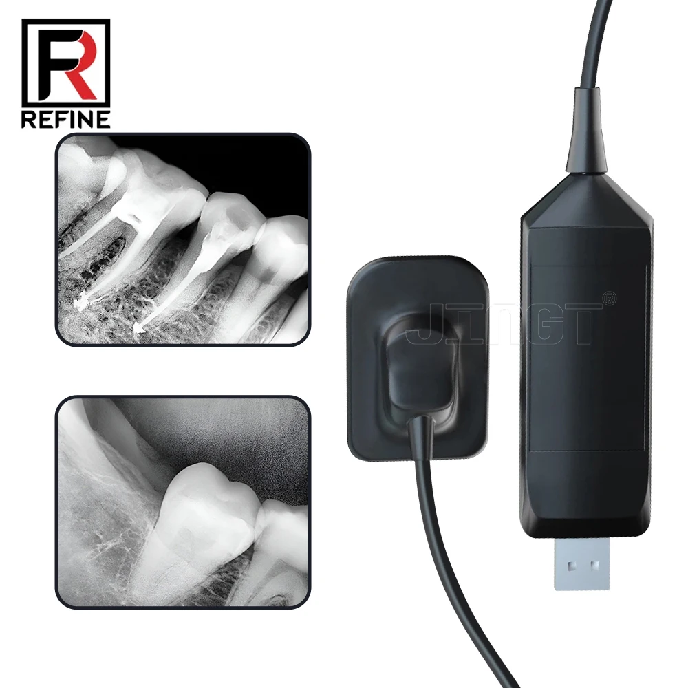 REFINE Intraoral Digital Dental X-ray Sensor HD Clear Rx Radiography System High Definition Intraoral X-ray Imaging Equipment