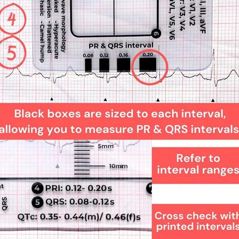ECG 7 Step Ruler ECG Ruler Plastic Ruler Measuring Tool For ECG/EKG Interpretation Easy-To-Carry With 1 Protect Sheath
