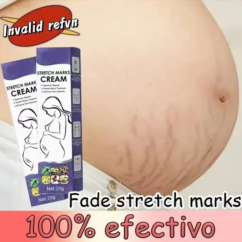 Cream For Pregnancy Stretch Marks Removal Eliminate Red White Old Stretch Marks Oil