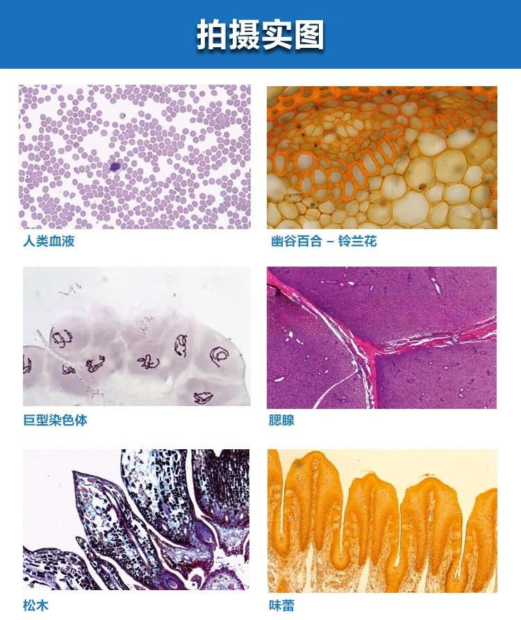 Microscopio biológico, microscopio trinocular binocular