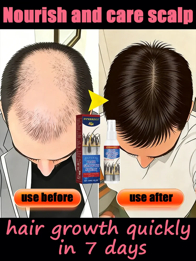 

Worried about thinning hairNᴏᴜʀɪsʜ ʏᴏᴜʀ sᴄᴀʟᴘ ᴀɴᴅ ʀᴇᴠɪᴛᴀʟɪᴢᴇ ʏᴏᴜʀ ʜᴀɪʀ ғᴏʟʟɪᴄʟᴇs.