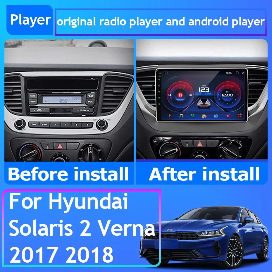 

For Hyundai Solaris 2 Verna 2017 2018 Car Radio Carplay GPS Navigation Android Auto Unit No 2din Multimedia Player Wifi