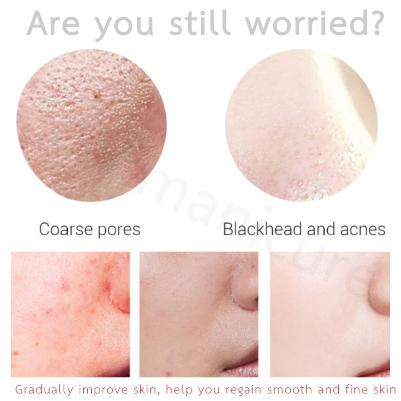 Fruit Acid Cleanser Lactobionic Acid Deep Cleansing Pores Removing Blackheads Pore Shrinkage Oil Control Facial Cleanser 100G
